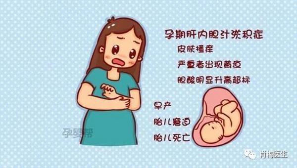 (来源:妊娠期肝内胆汁淤积症诊疗指南2015)妊娠期肝内胆汁淤积症是一